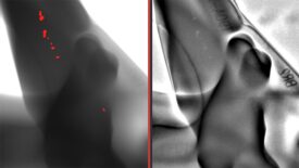 This comparison shows a casting with cavities, which the AI-supported module reliably detects – on the left in the image.